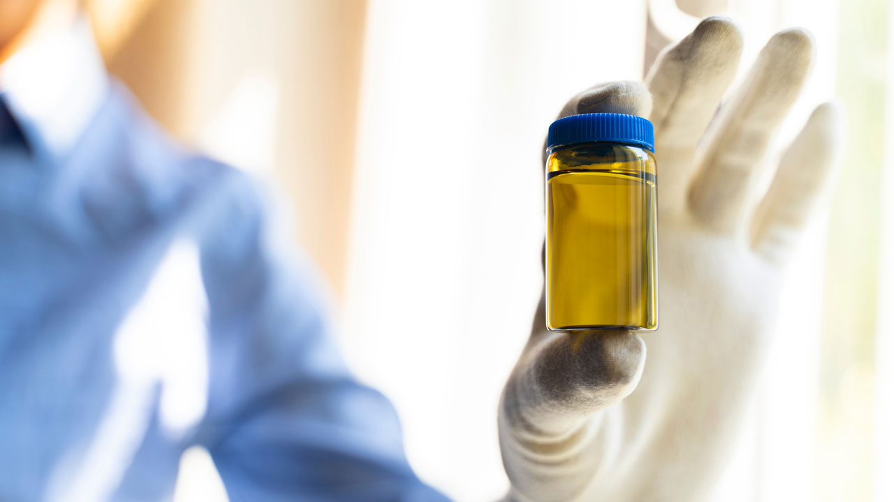 Monstercontainer met urinemonster voor biologische monitoring, vastgehouden door een gehandschoende hand