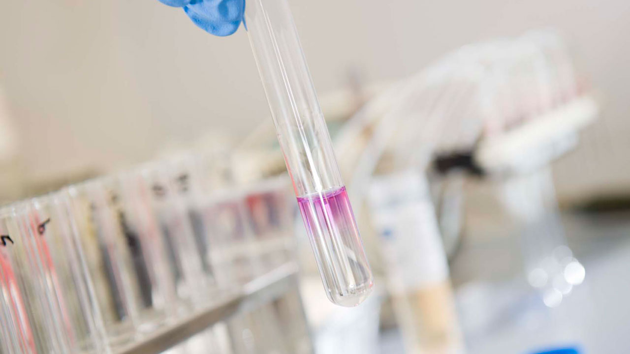 Reageerbuis met roze vloeistof in laboratorium – microbiologische analyse van water- en milieumonsters bij Tetra Tech