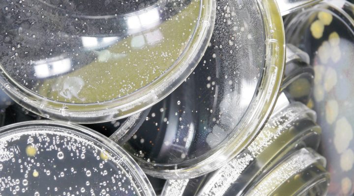 Petrischalen met vloeistoffen gestappeld voor microbiologische analyses